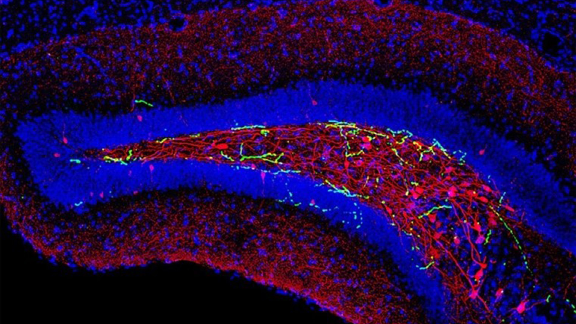 IEM researchers' recent findings suggest that the brainstem also plays a role in memory recall