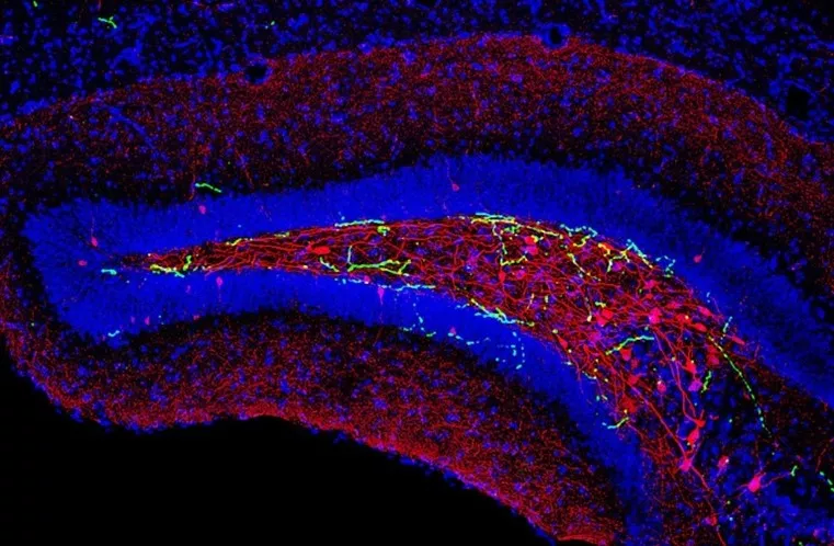 IEM researchers' recent findings suggest that the brainstem also plays a role in memory recall