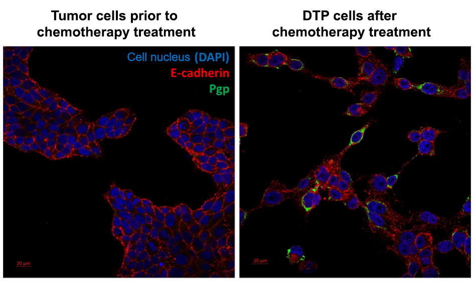 HUN-REN TTK researchers identify a new target in tumor cells that survive chemotherapy