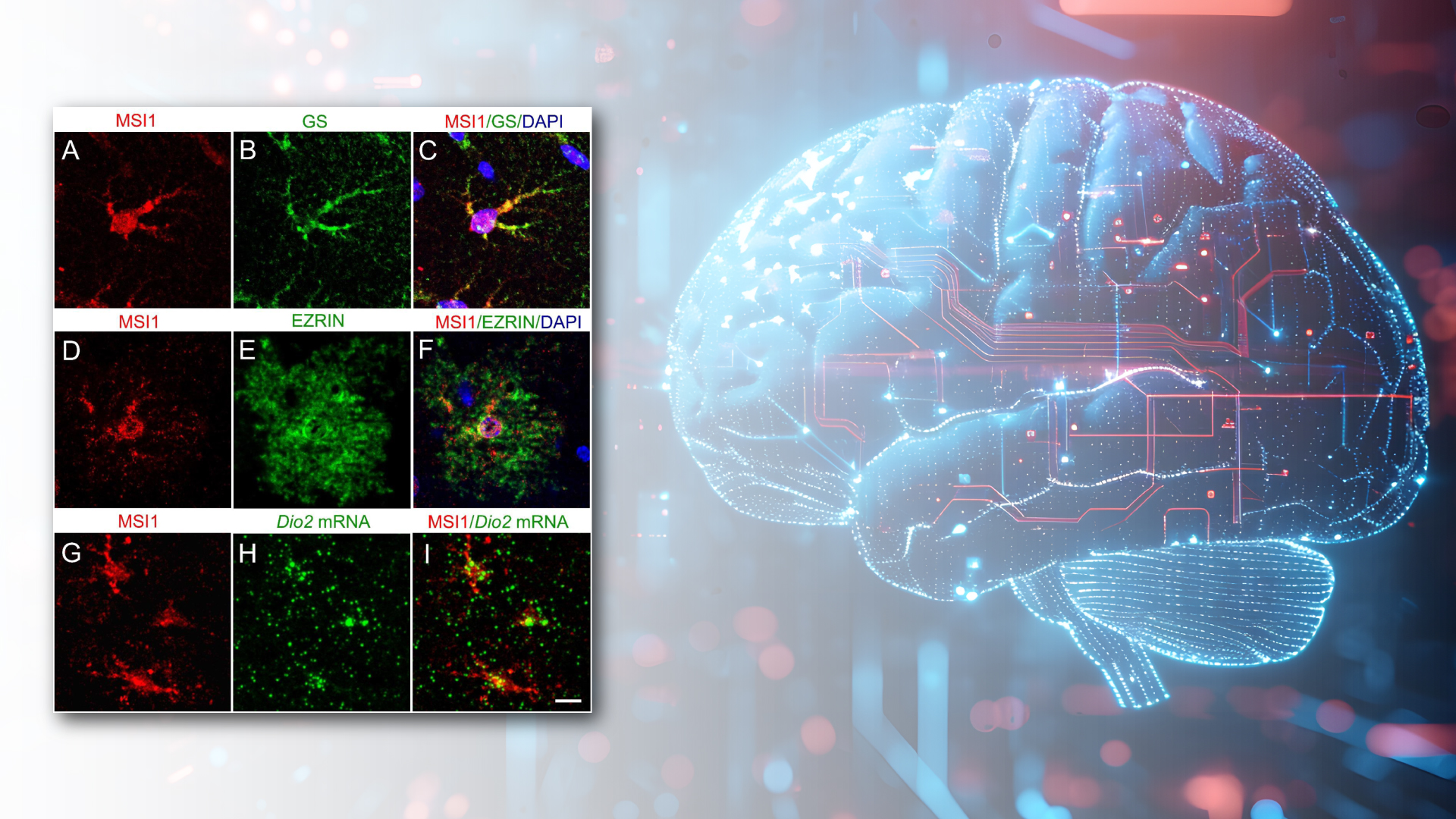 A Novel Mechanism of Cell Proliferation Discovered In HUN-REN IEM Could Play a Role in The Formation of Human Gliomas